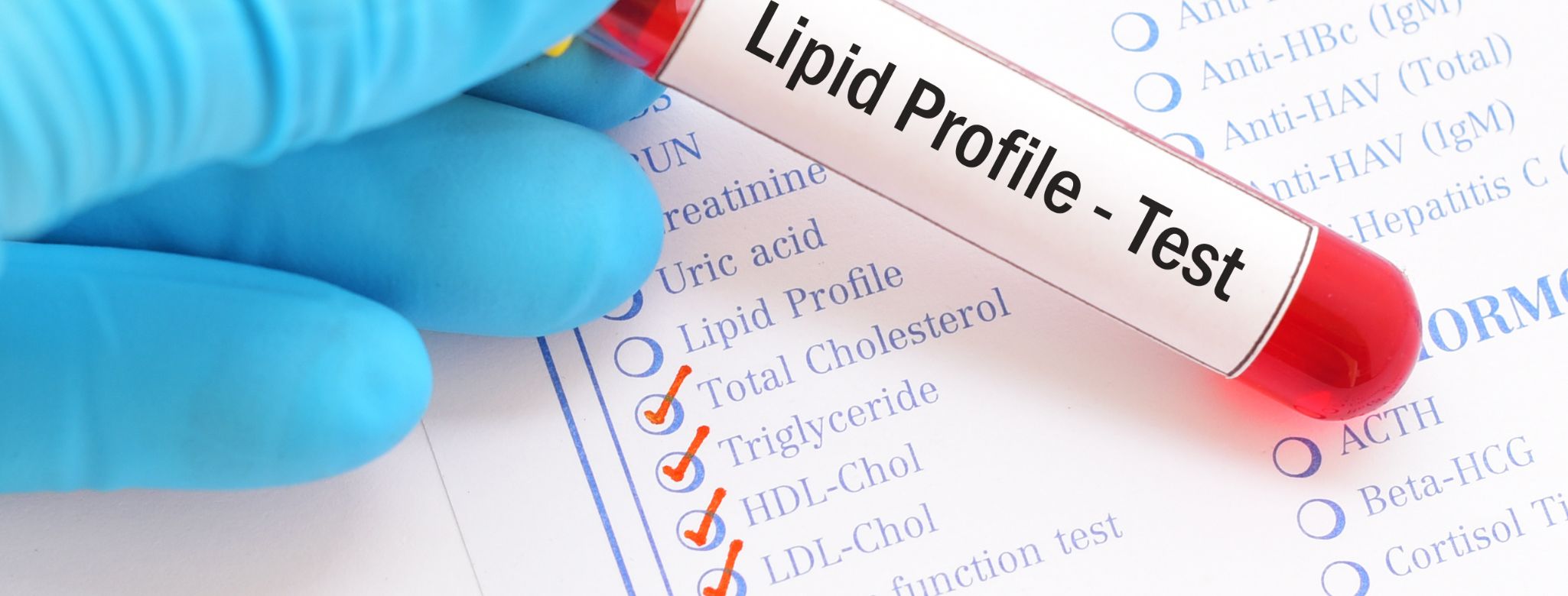 Test na lipidy v krvi